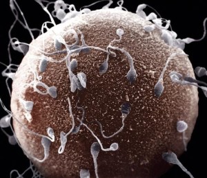 Степень вязкости спермы 