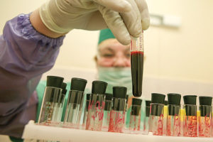 анализы на ВИЧ в лаборатории